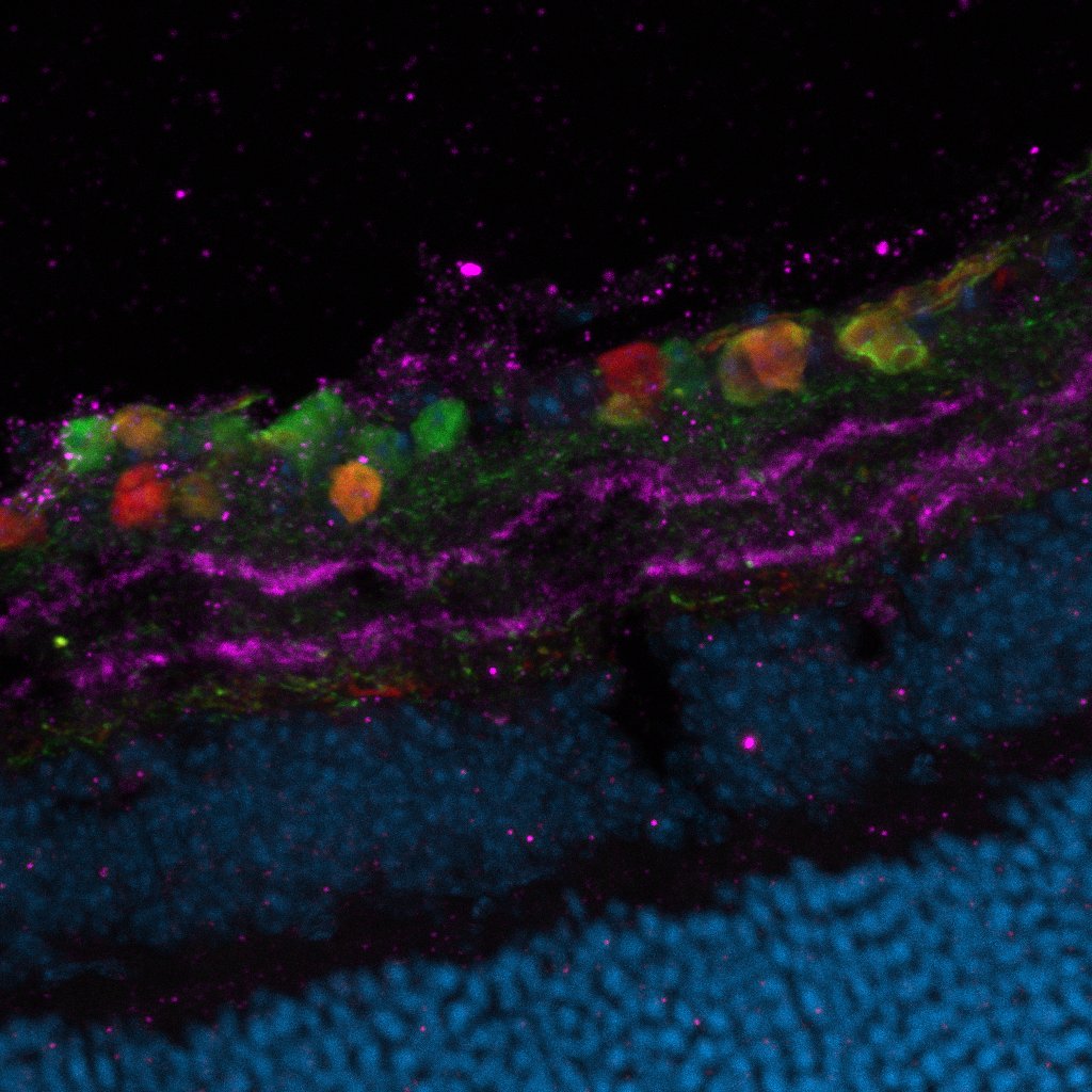 Retina Research